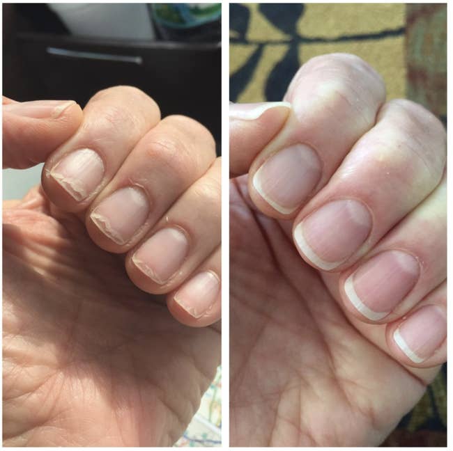 Before and after using cuticle nail oil