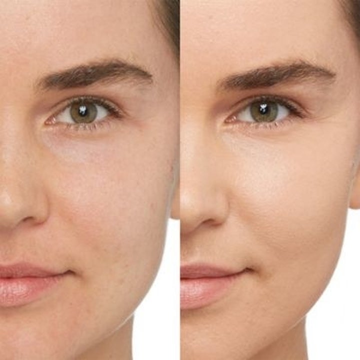 a model's skin before and after using the product