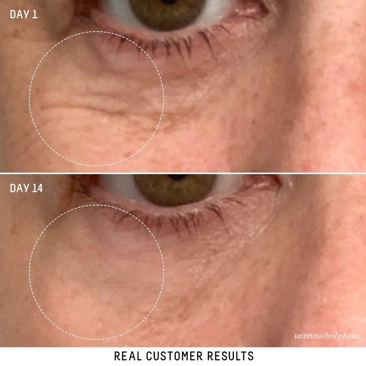 a before-and-after photo showing the reduction of a person's fine lines under their eyes after using the cream