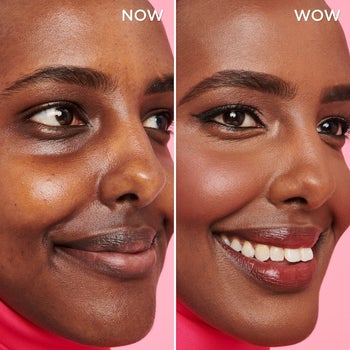 a model showing their skin before and after using the spray