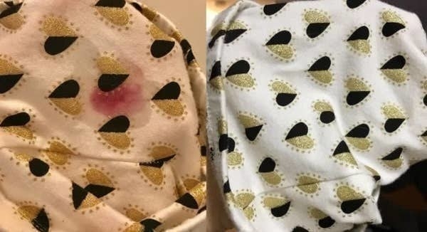 On the left, a piece of fabric with a pink stain on it, and on the right, the same piece of fabric now completely cleared up and looking brand new
