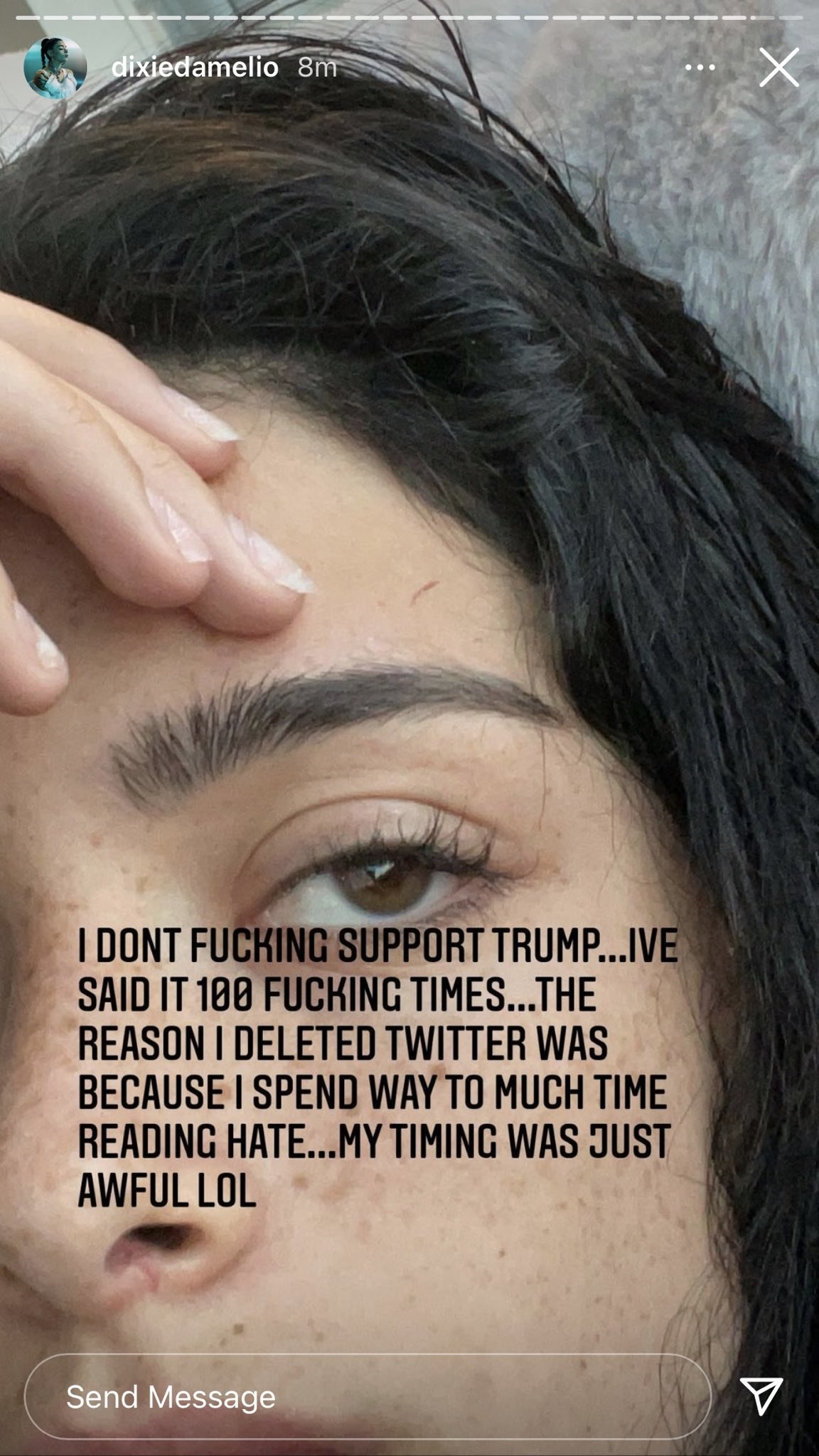A screenshot of Dixie's Instagram story which reads I don't fucking support Trump
