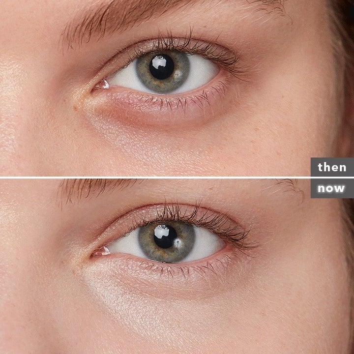 a model's before and after photos using the product