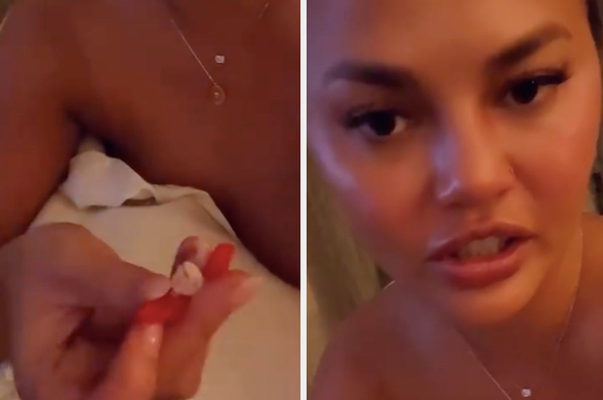 Chrissy Teigen Lost A Tooth Eating A Fruit Roll-Up