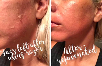 on the left, a reviewer showing peach fuzz on their cheek, and on the right, the same reviewer showing the peach fuzz now gone 