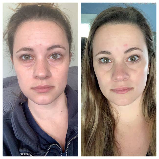 Reviewer showing before and after using the eye cream