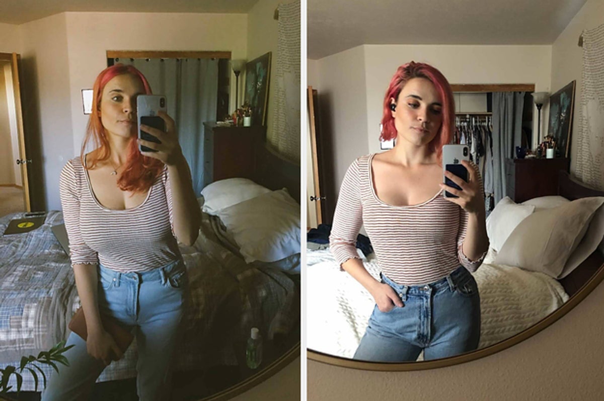My Breast Reduction Surgery Finally Gave Me The Body I Was Meant To Have
