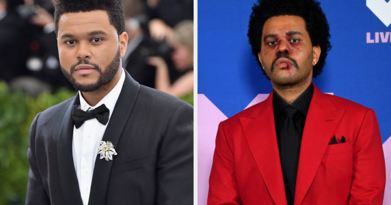 The Weeknd Talks Grammy Snub