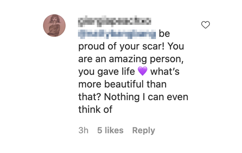 Comment saying, &quot;Be proud of your scar! You are an amazing person, you gave life. What&#x27;s more beautiful than that? Nothing I can even think of.&quot;