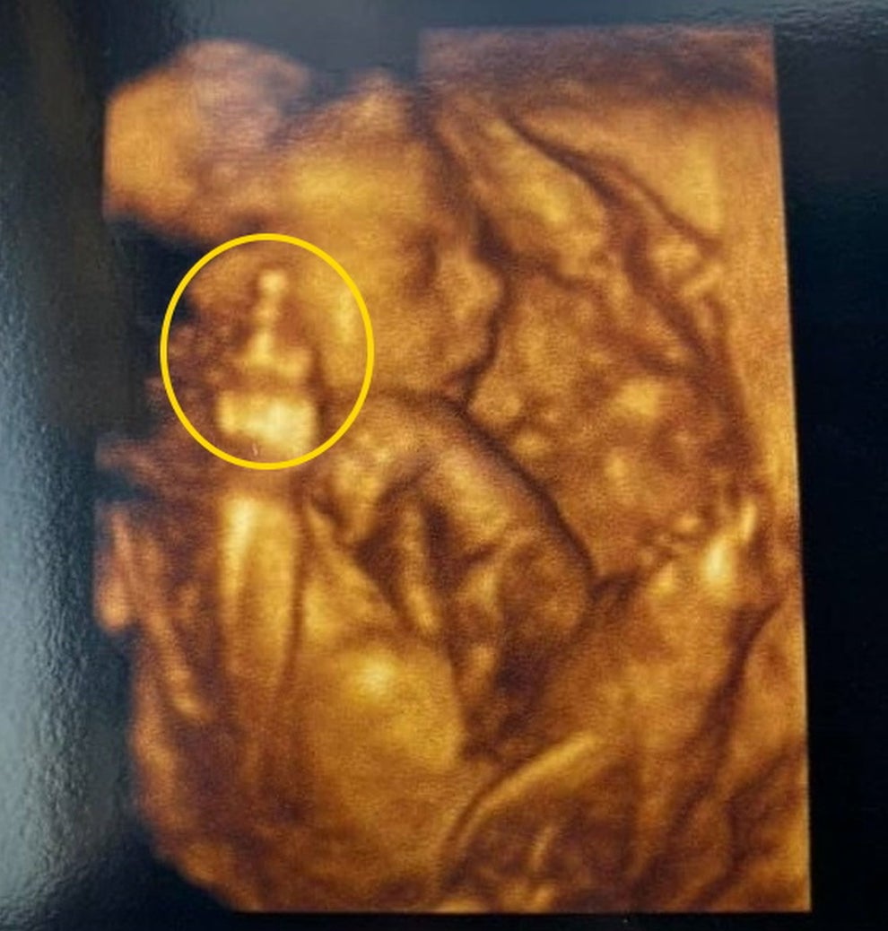 お腹の赤ちゃんをエコー写真で撮影したら 中指立ててたんですけど 笑