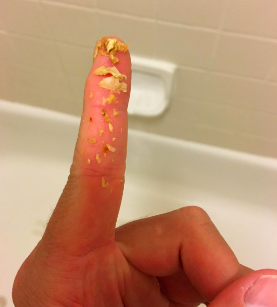 A customer review photo of a clump of earwax on their finger