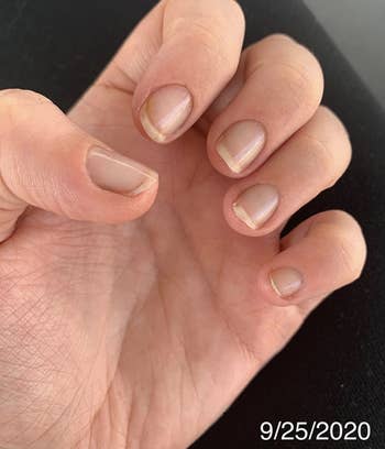 a reviewer's nails looking short 