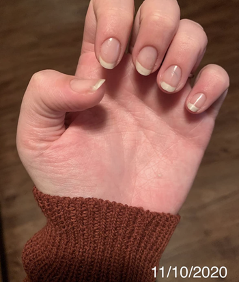 the same reviewer's nails, less than two months later, now looking longer and stronger