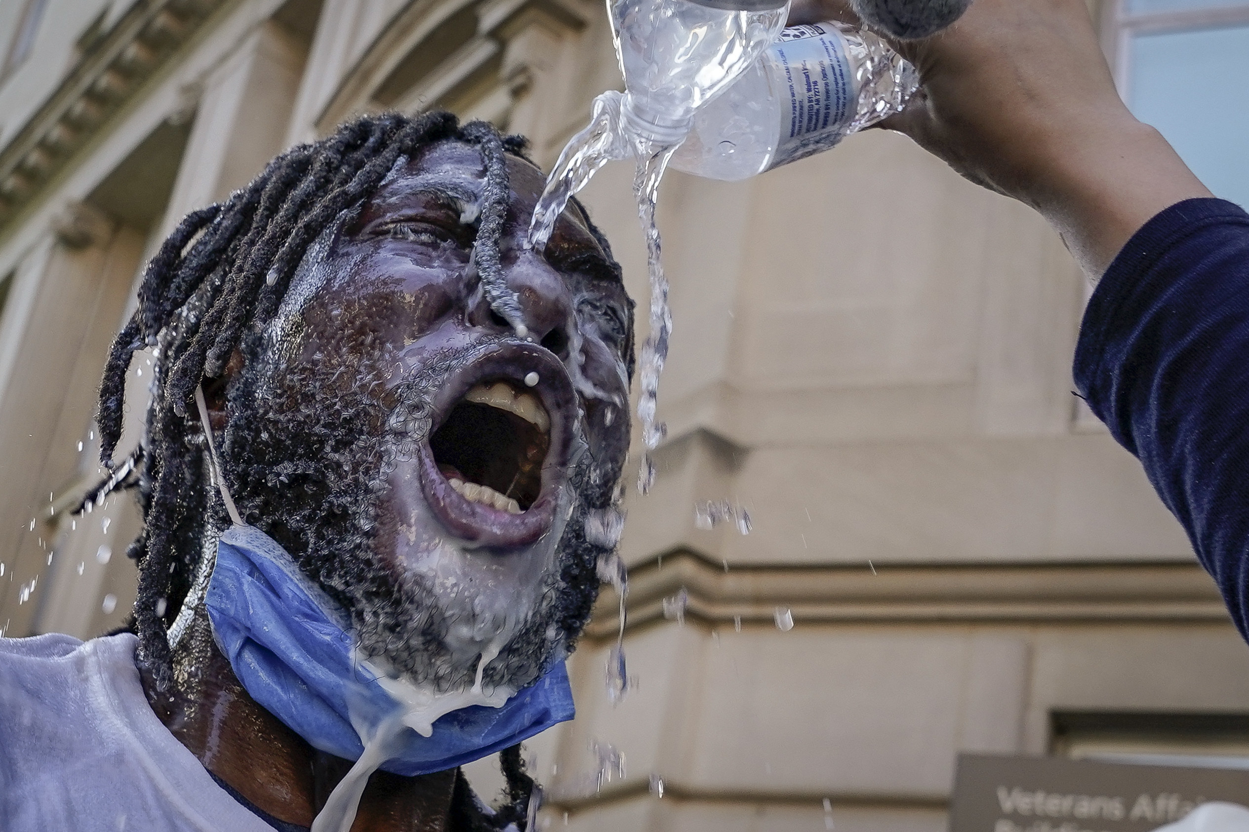 A protestor being doused with water and milk after being pepper sprayed