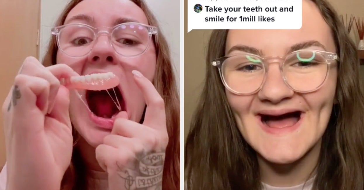 Woman On TikTok With Dentures