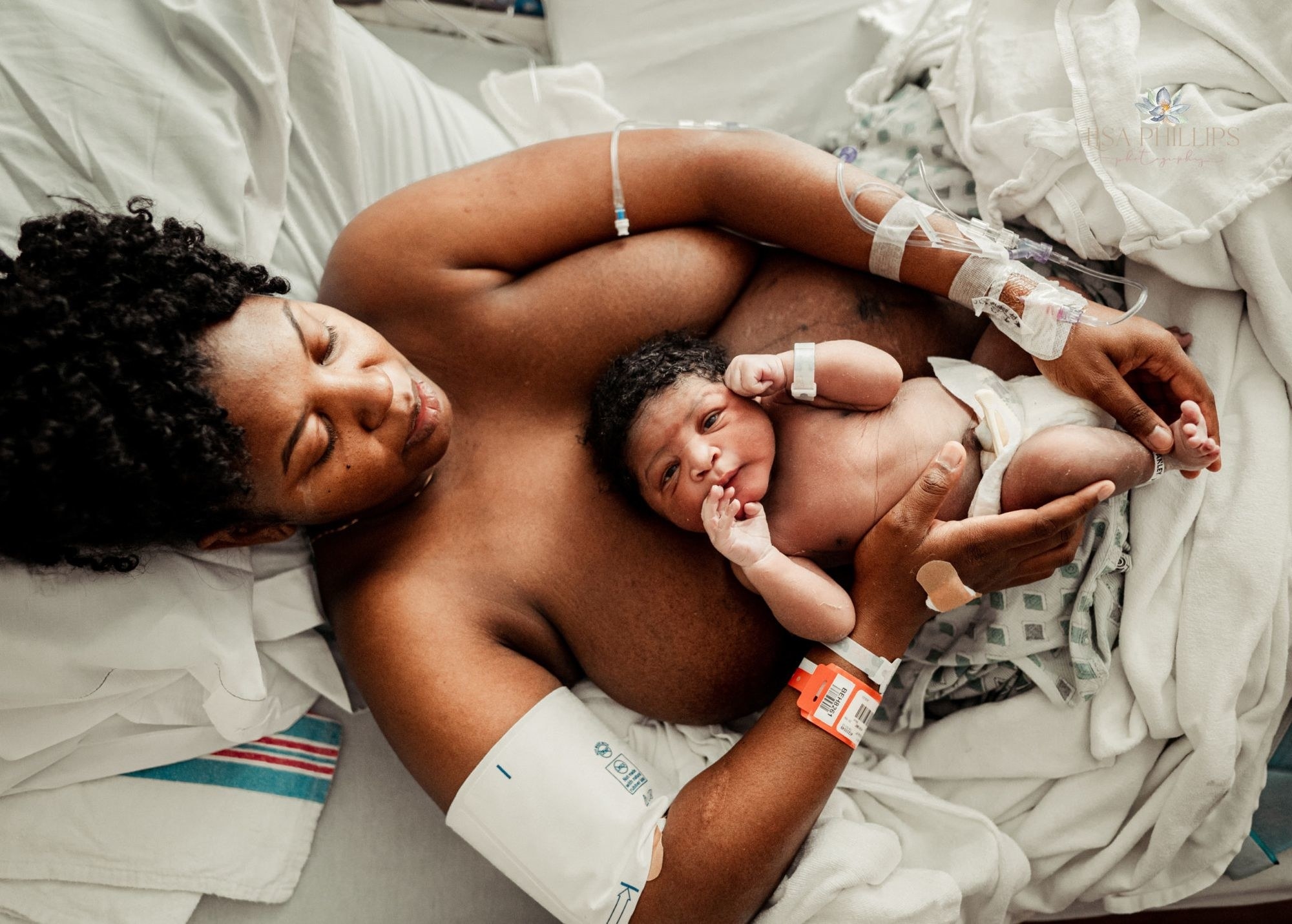 A baby rests on her mother&#x27;s chest in a hospital bed