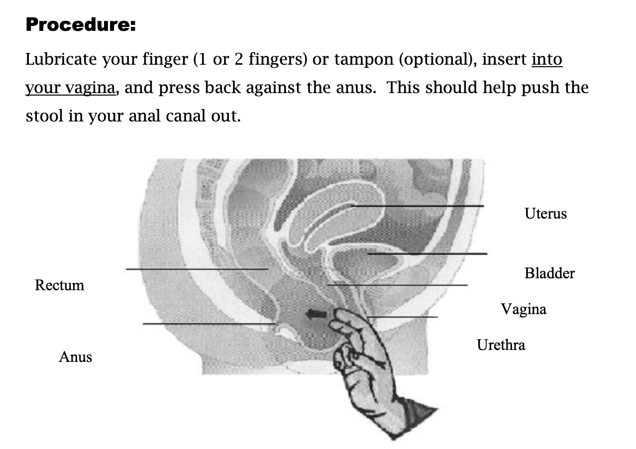 A diagram of fingers up a vagina.