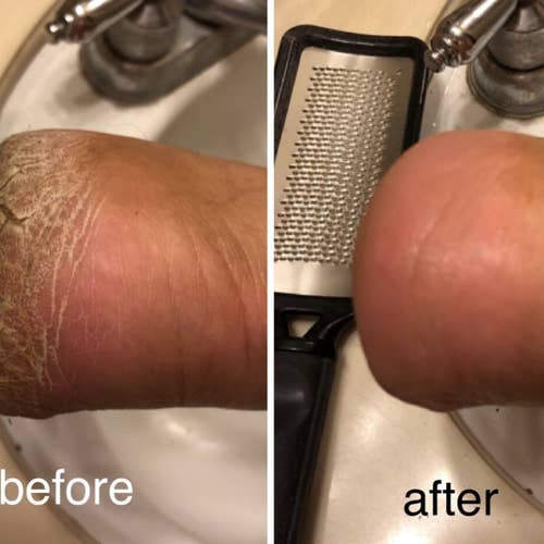 a before-and-after photo of a reviewer's cracked heel now looking soft and smooth