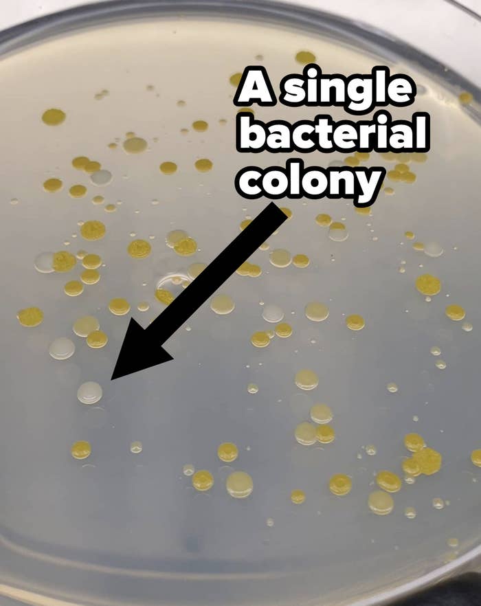 An arrow pointing to a single bacterial colony