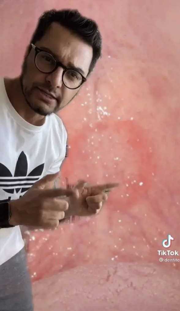 Guy pointing at a bruised soft palate