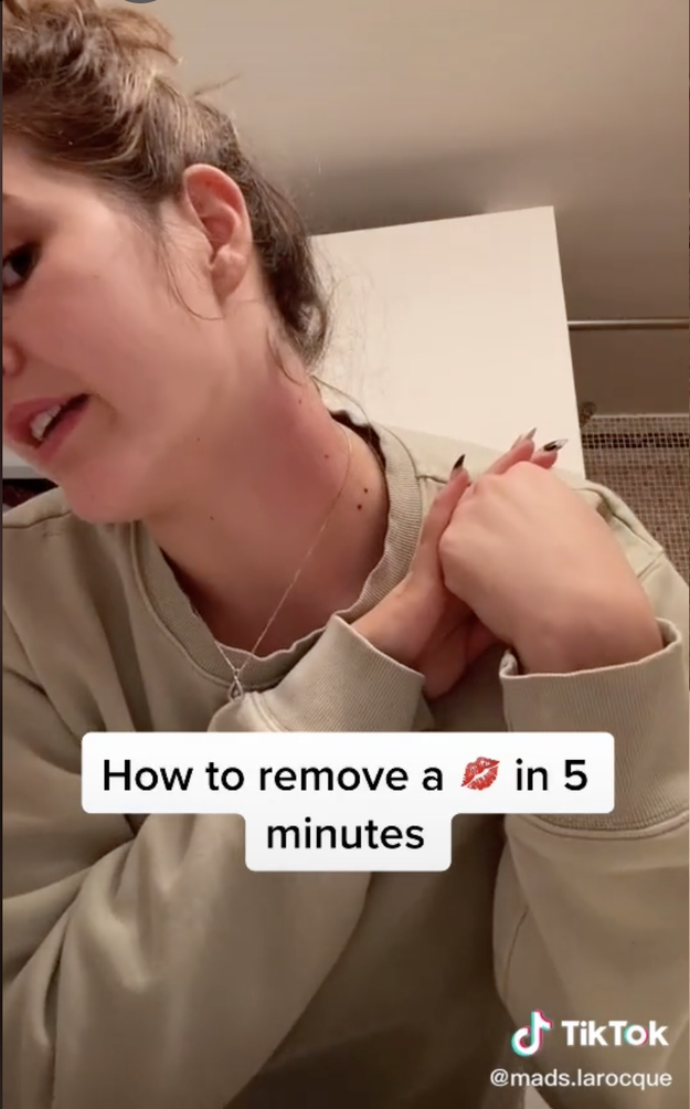 How to.remove deals hickies