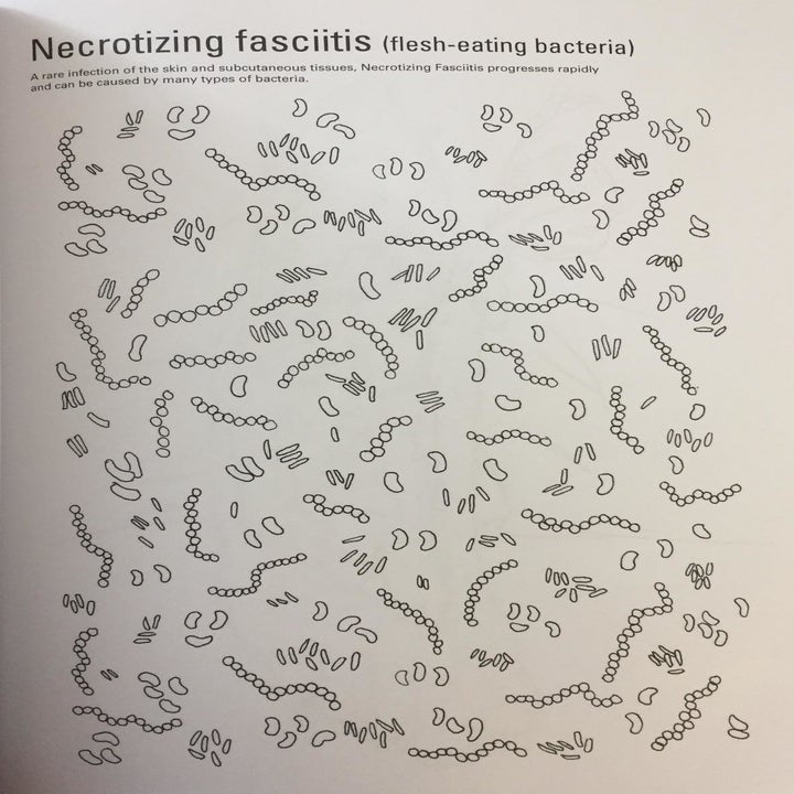 coloring page of necrotizing fasciitis
