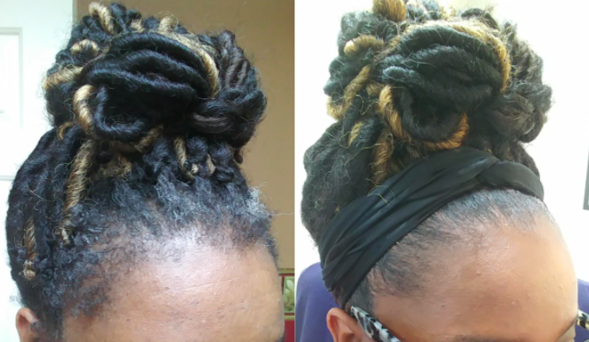 A before and after customer review photo of their edges