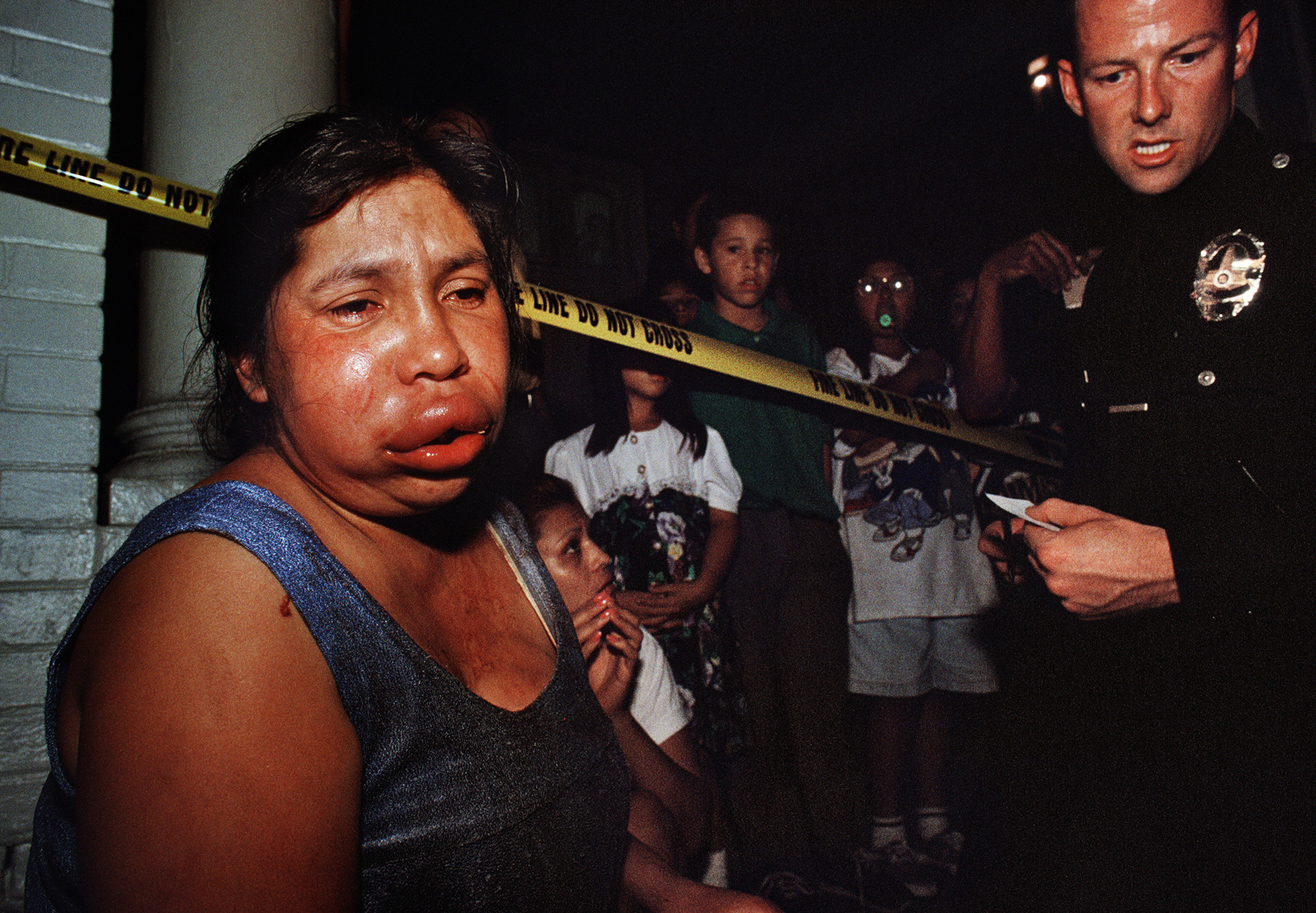 A woman with a fat lip who has been crying looks off in the distance as a crowd of children watch from behind police tape and a police officer looks on