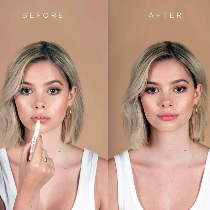 A before and after where the after shows visibly rosier, plumper lips