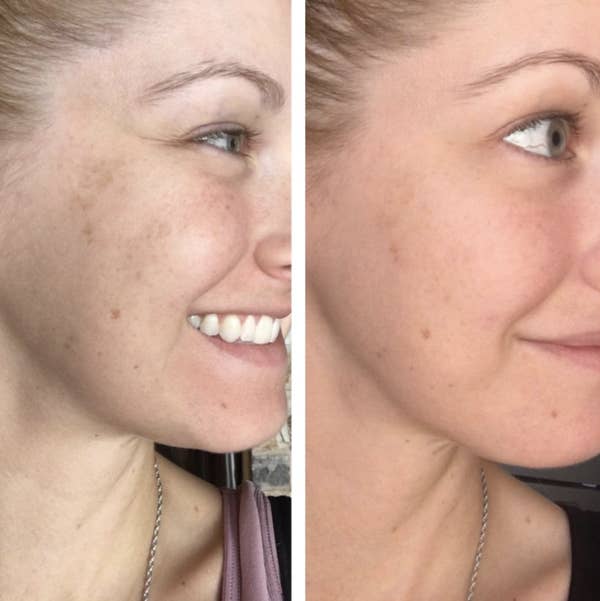 Before and after image of reviewer with more refreshed skin after use 