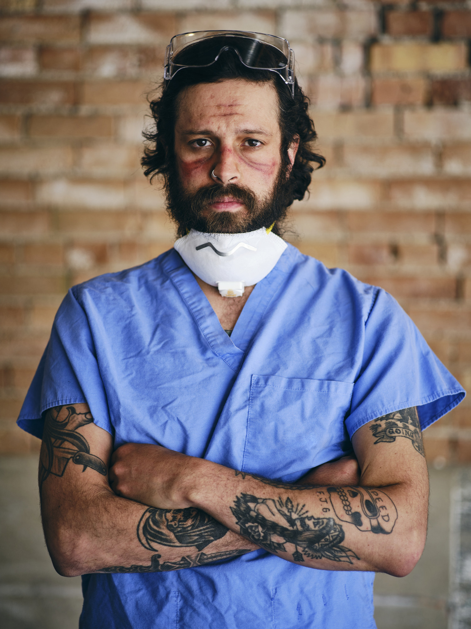 A doctor with deep scars on his face from the surgical goggles