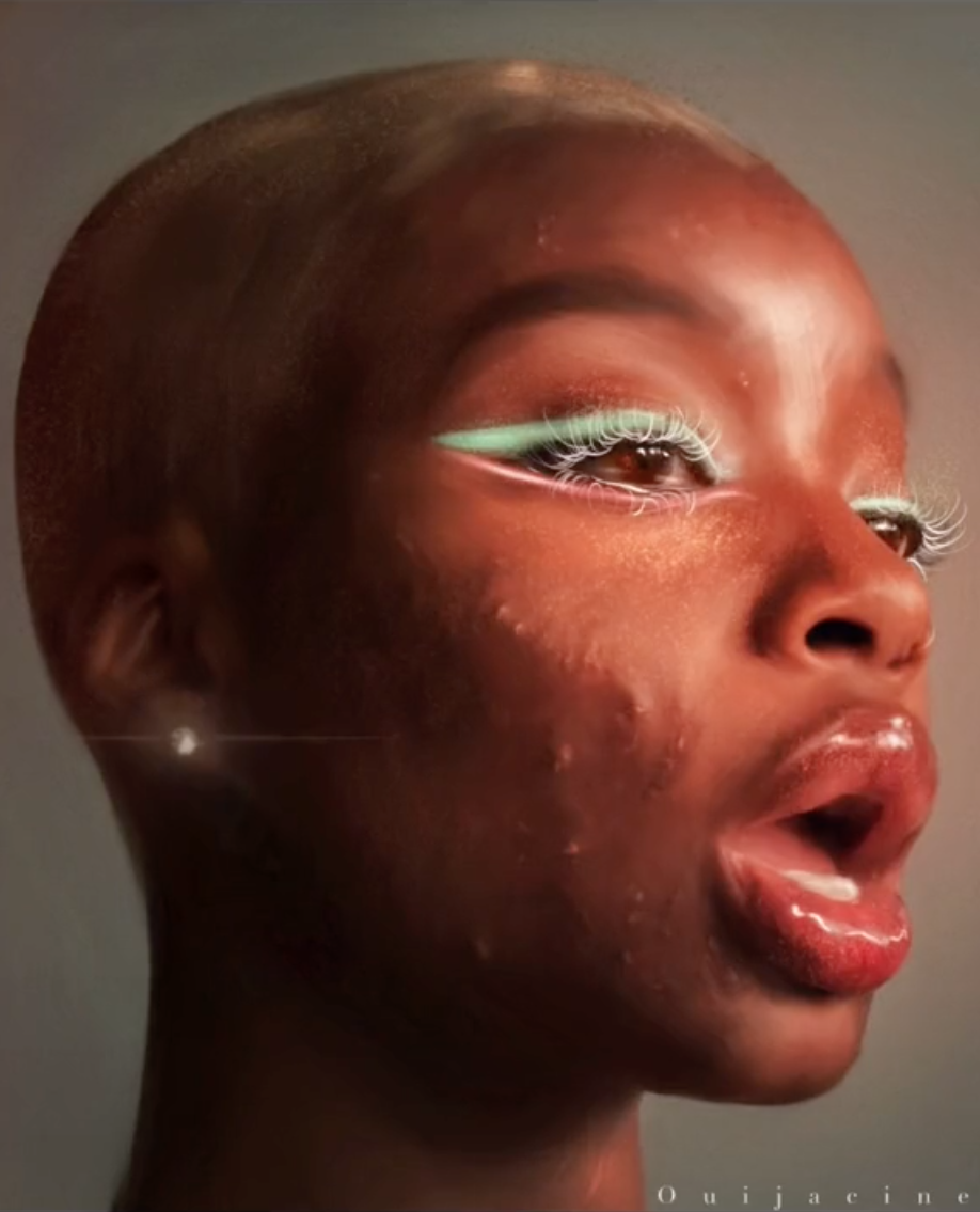 A realistic and captivating portrait of someone with acne