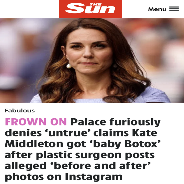 FROWN ON: Palace furiously denies ‘untrue’ claims Kate Middleton got ‘baby Botox’ after plastic surgeon posts alleged ‘before and after’ photos on Instagram