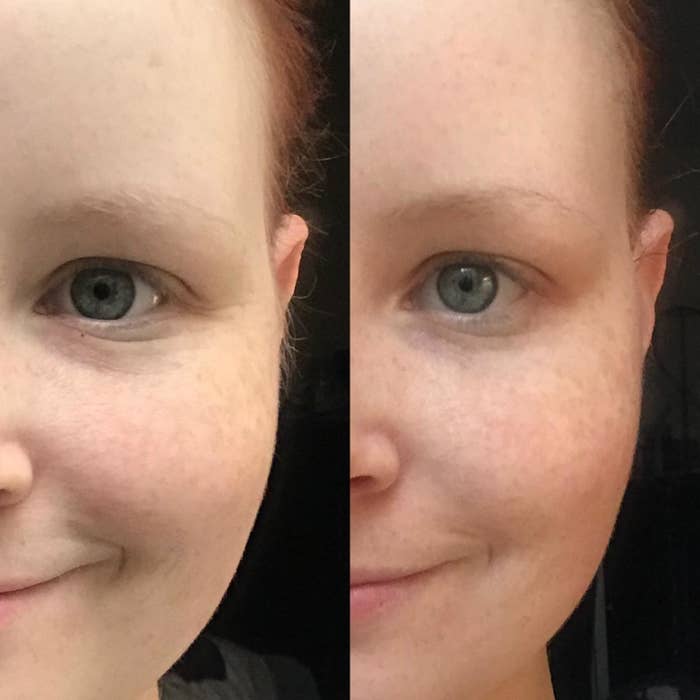 reviewer photo showing their under-eye area before and after using the Zombie mask