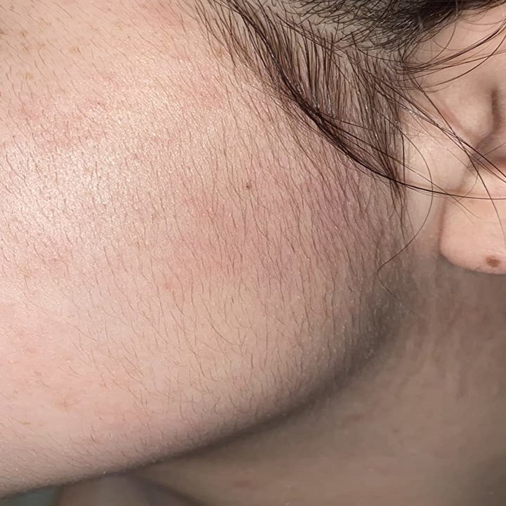 reviewer showing hair on their cheek 