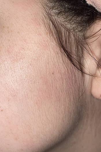 reviewer showing hair on their cheek 