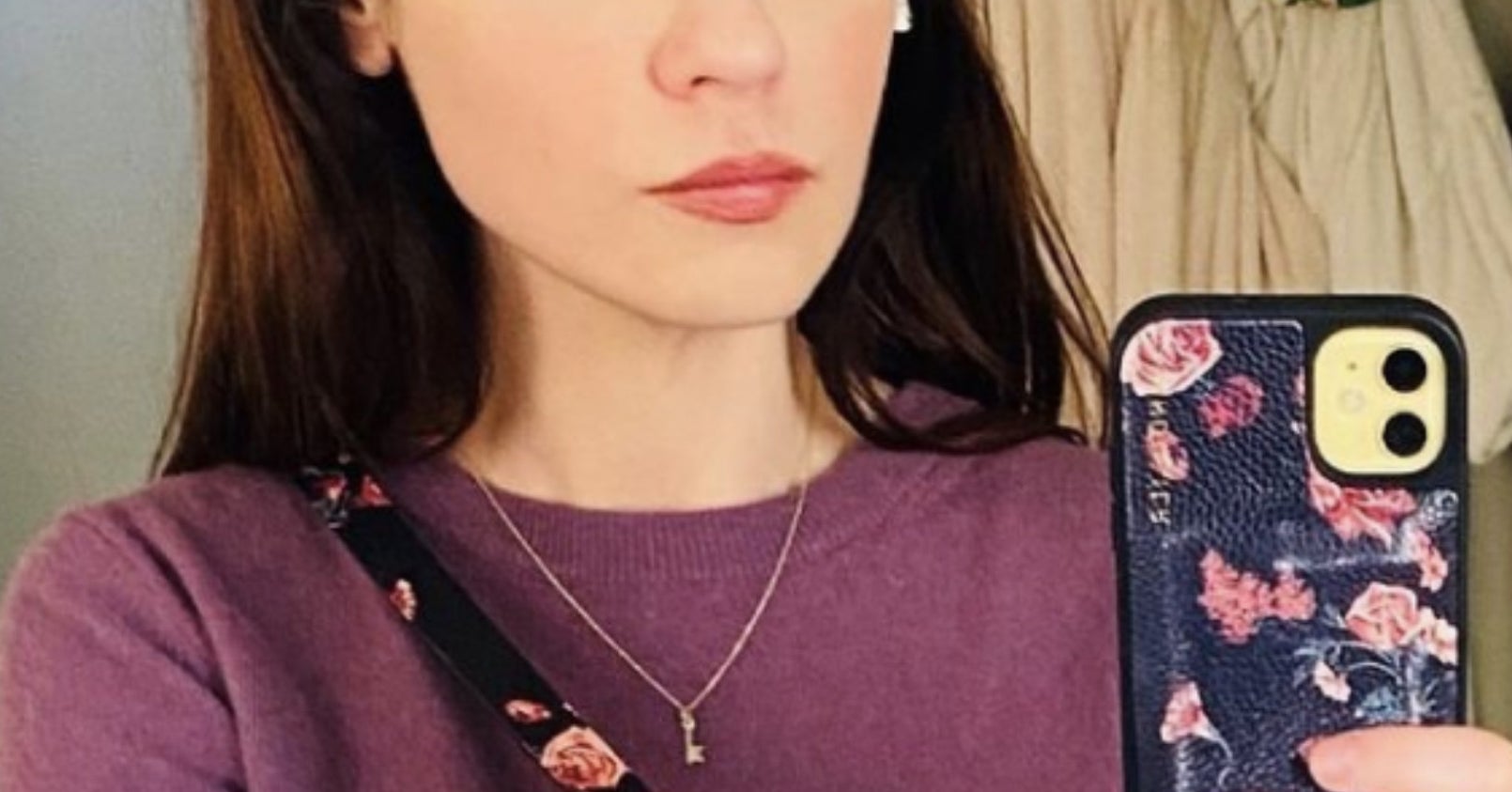 Zooey Deschanel Posted An Instagram Of Her Forehead