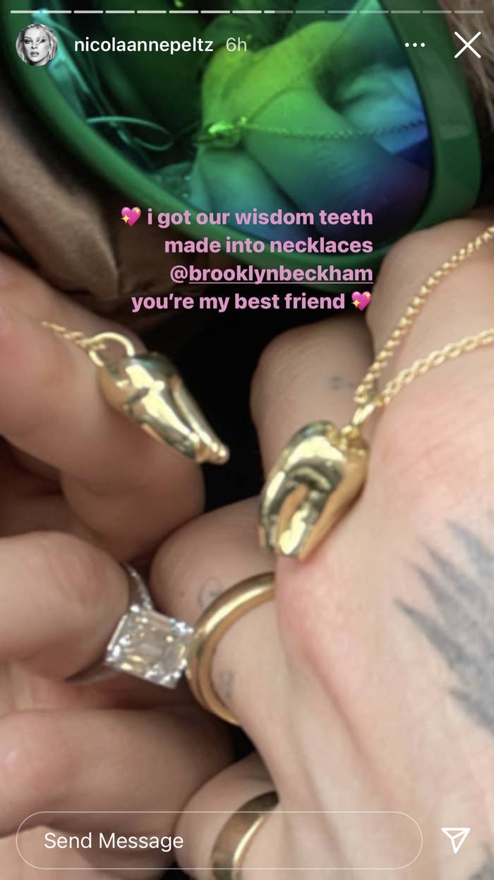 Golden jewelry made out of Nicola Peltz and Brooklyn Beckham's wisdom teeth