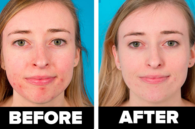 33 Skincare Basics You'll Probably Wish You Had Learned Sooner