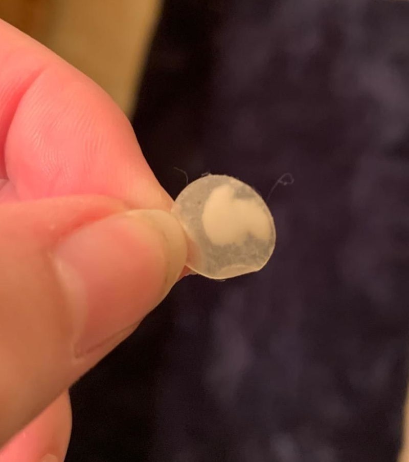 amazon reviewer&#x27;s clear pimple patch full of sebum