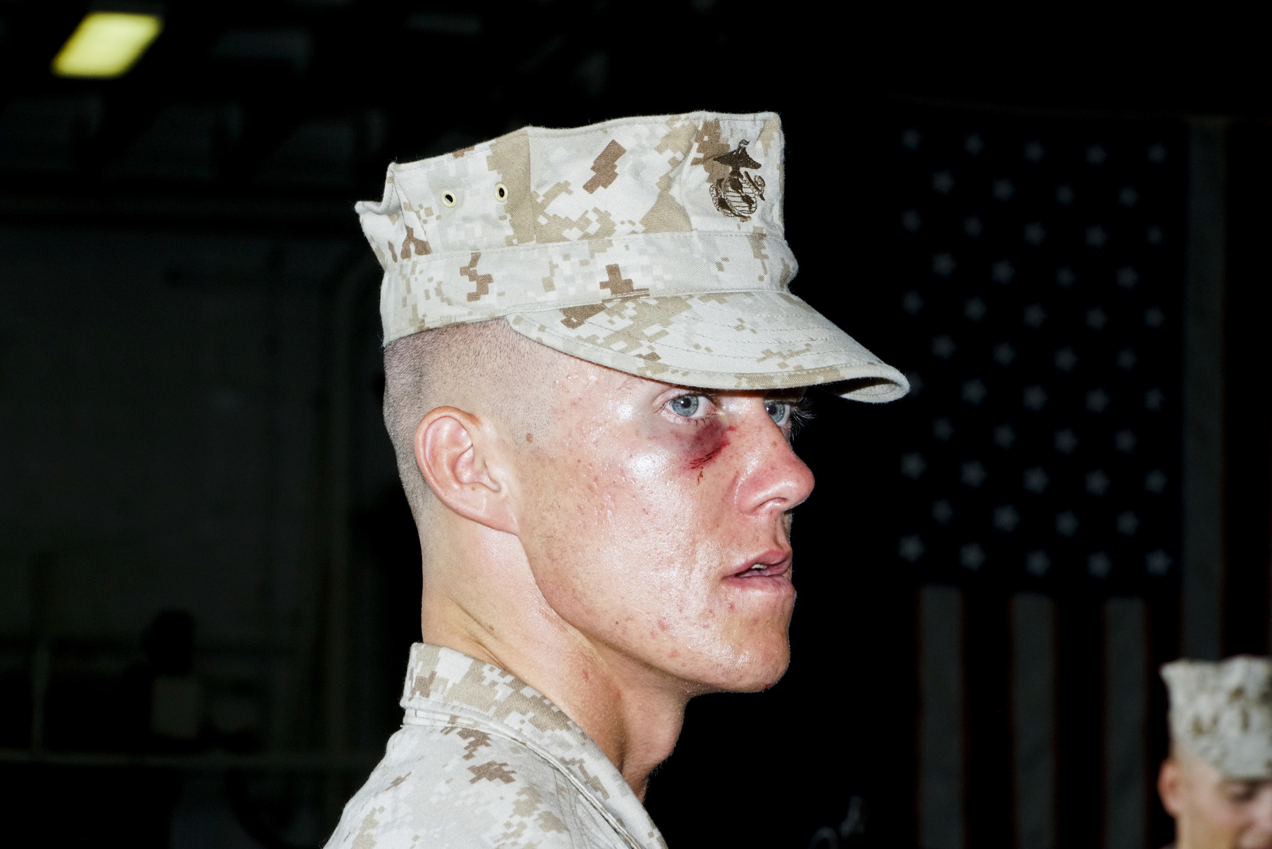 A man in Marine uniform with a black eye looks past the camera