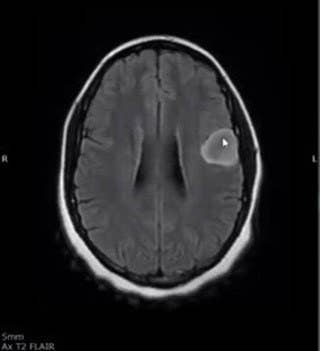 Theandra's brain scan