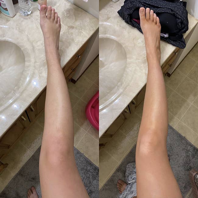 reviewer with pale skin before using the tanning drops, then same leg looking more golden tan