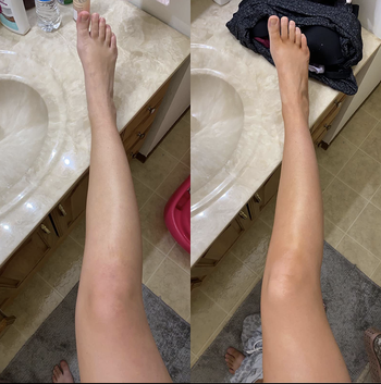 reviewer pic with pale skin before using the tanning drops, then same leg looking more golden tan