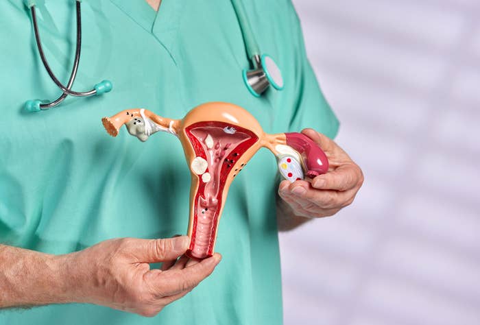 Obstetrician gynecologist holding teaching tool model of women&#x27;s uterus and ovary