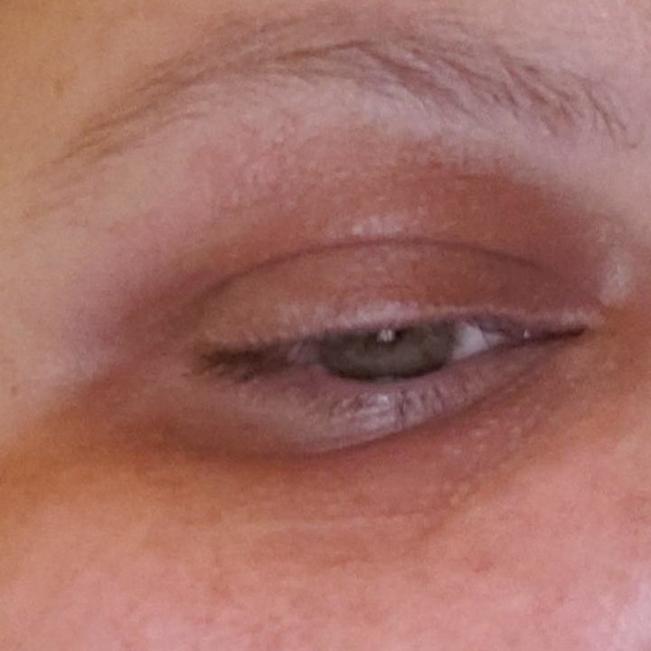 A reviewer's eye before using the product, showing dark circles