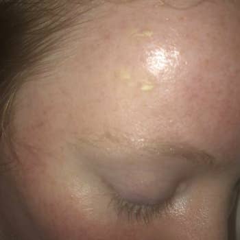 A customer review photo showing their clear skin after using the chemical exfoliant