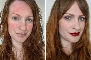 A side by side image of Lex with a bare face, showing her rosacea, next to an image of her with full make up covering her rosacea. She is smiling in both pictures.