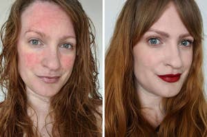 A side by side image of Lex with a bare face, showing her rosacea, next to an image of her with full make up covering her rosacea. She is smiling in both pictures.