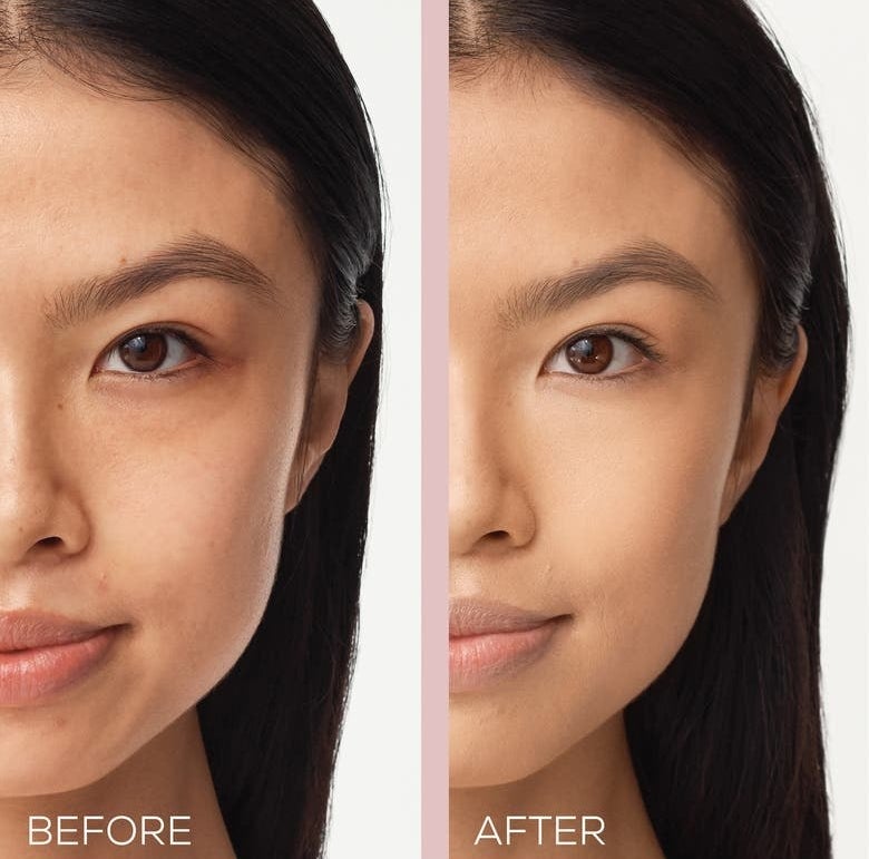 A model before and after applying the product, with circles under eyes less visible after